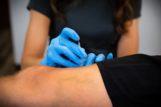 Dry Needling